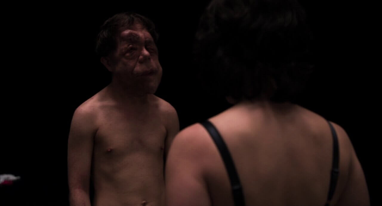 under the skin malformed man